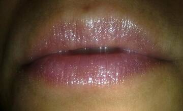 kisss